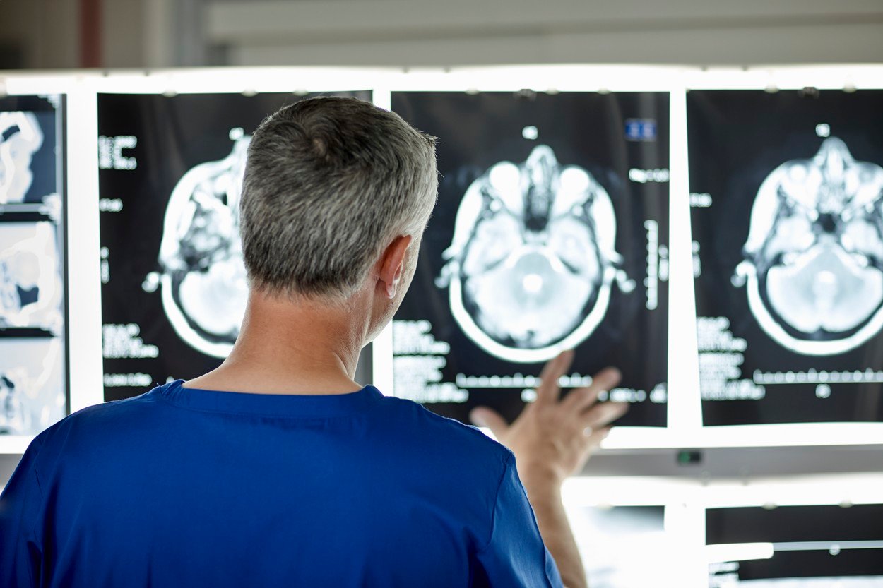 Poluarea aerului e asociată direct cu apariţia bolii Alzheimer. Concluziile unui studiu pe 27 de milioane de oameni 1 wp header logo 1646