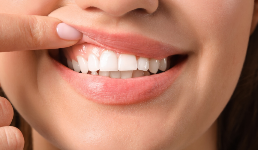 Cum să obții dinți mai albi acasă. Rețeta naturală pentru un zâmbet ca la Hollywood 1 wp header logo 1252