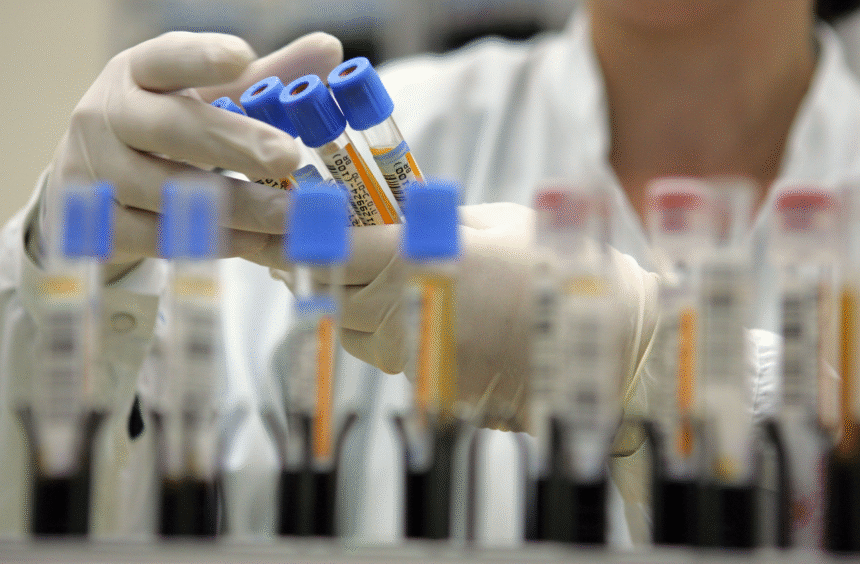 Un studiu dezvăluie cele 37 de proteine din sângele centenarilor legate de o viață mai lungă și mai sănătoasă 1 wp header logo 567