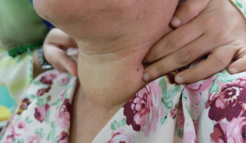 Boala care te îngrașă indiferent de dieta pe care o ții 1 wp header logo 1258