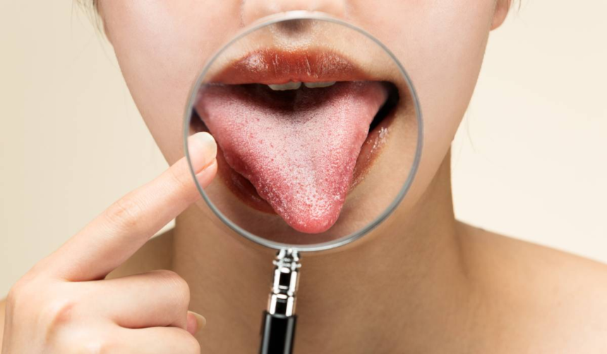 De ce simți gust metalic în gură și când ar trebui să te îngrijorezi 1 wp header logo 29