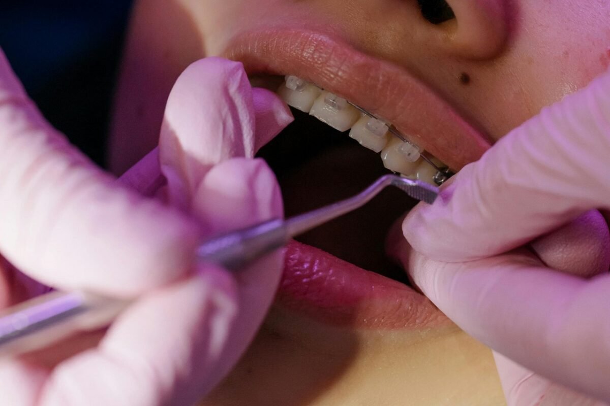 (P) 5 motive pentru care merită să alegi un aparat dentar din safir 1 wp header logo 1281