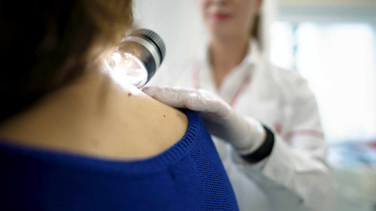 Primul centru multidisciplinar integrat pentru tratarea melanomului s-a deschis în cadrul Spitalului Euroclinic 1 wp header logo 876