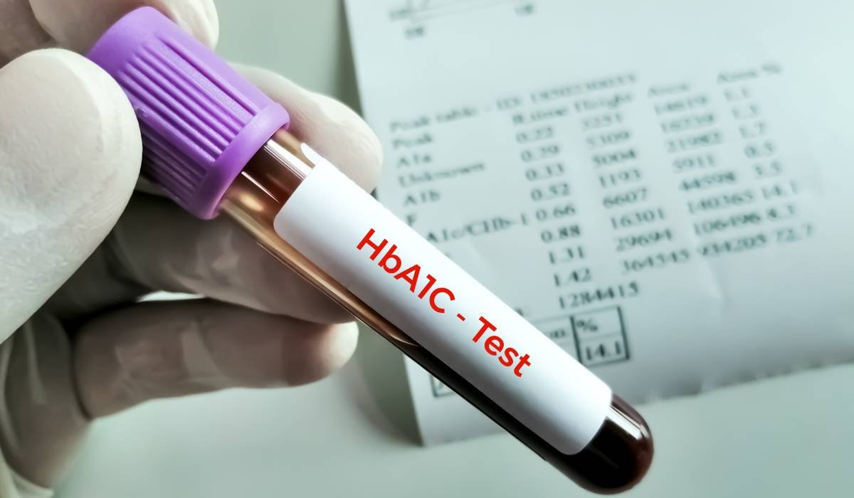 De ce poate crește hemoglobina glicată (HbA1c)? Glicemia ridicată nu este singura explicație 1 wp header logo 1399