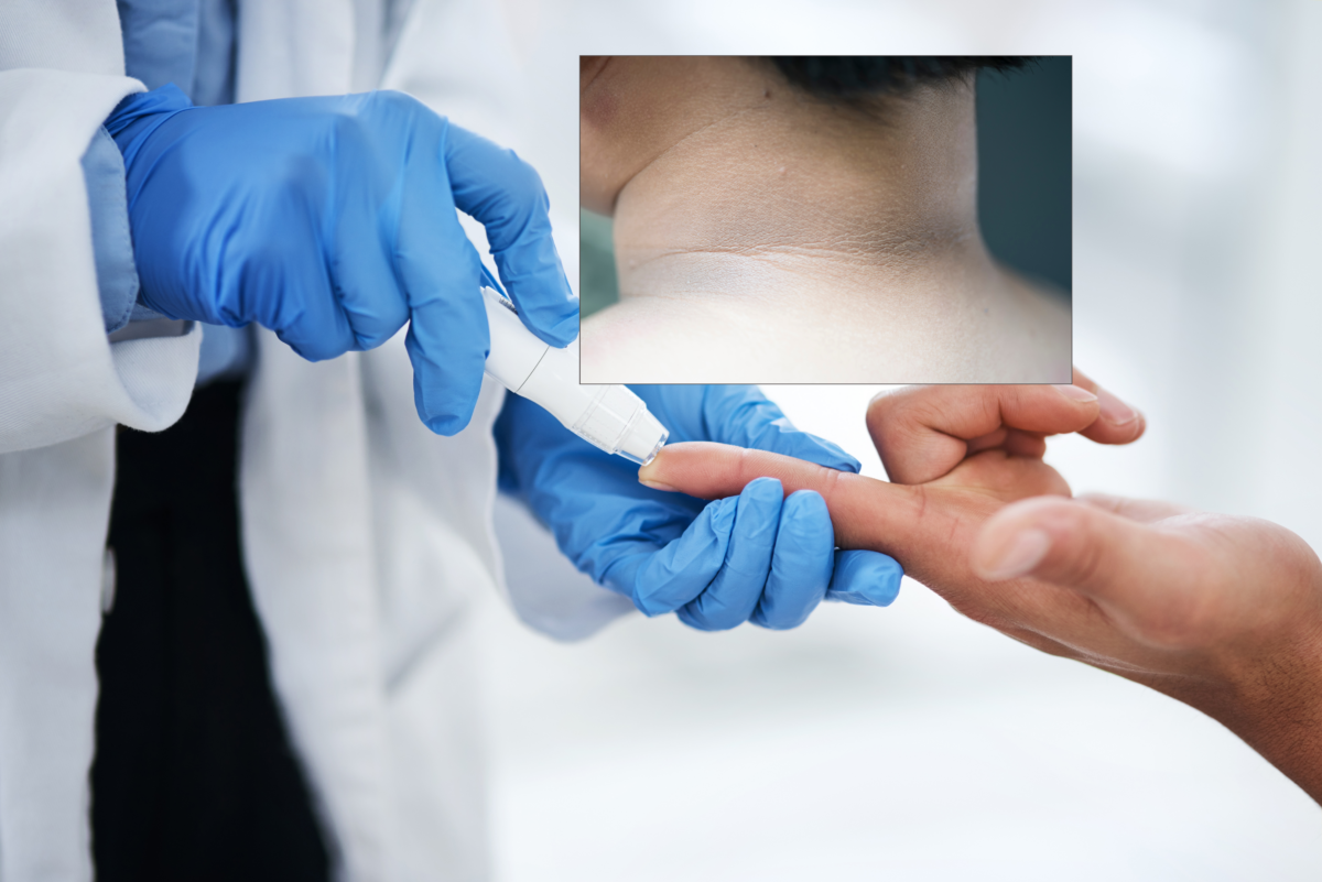 Medicii avertizează: o pată închisă la culoare pe piele poate fi un semn al diabetului de tip 2 1 wp header logo 1461