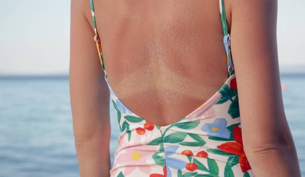 Ce se întâmplă în piele când alternezi bronzul natural cu solarul 1 wp header logo 73