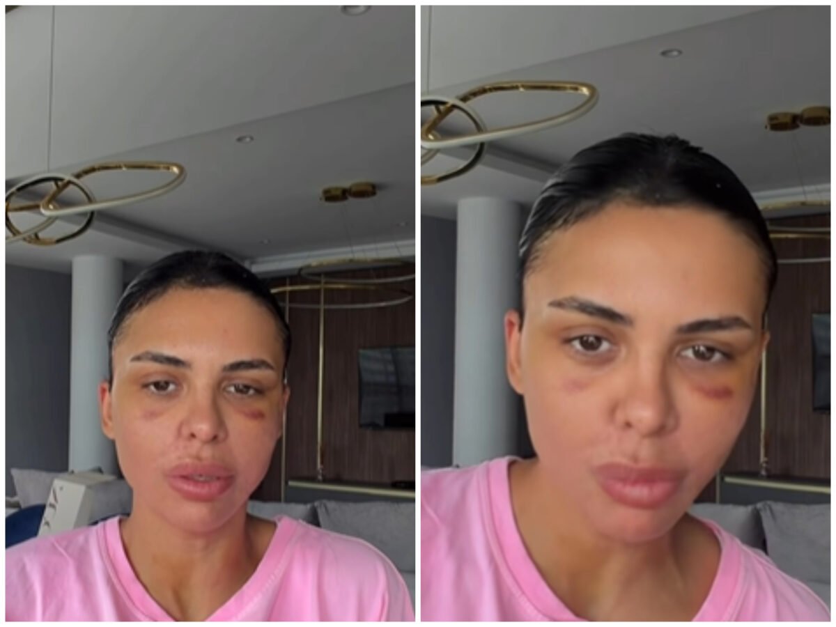 Andreea Popescu, dezvăluiri despre ultimele operații suferite: „Mi-a căzut părul enorm”. Ce intervenții estetice și-a făcut vedeta 1 wp header logo 1372