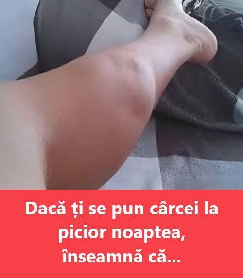 Ce semnifică apariția cârceilor nocturni la picioare – cauza la care nu te-ai fi gândit 1 764855187 28730354039899845 5862530888922069652 n